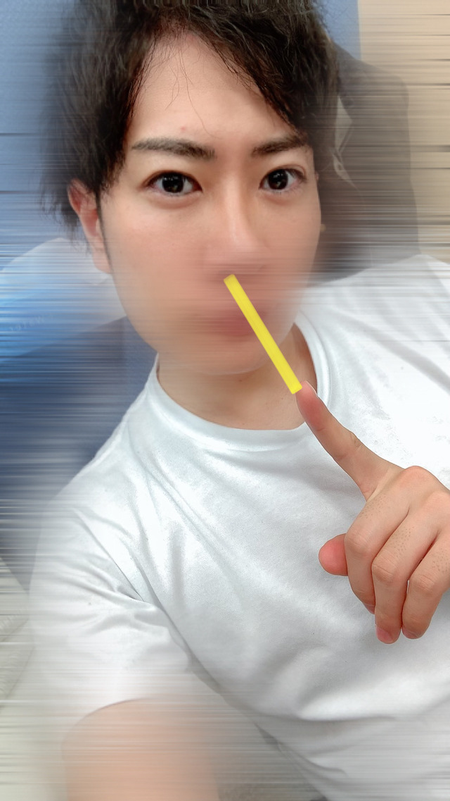 粘膜レーザー
