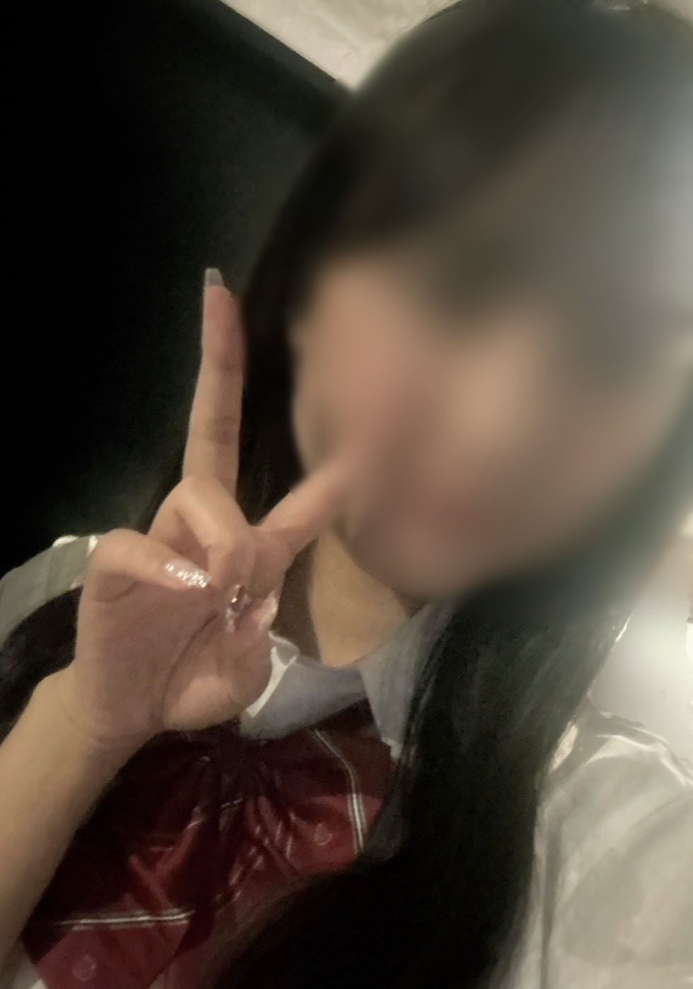 える