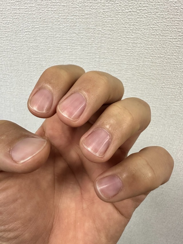 オトコネイル