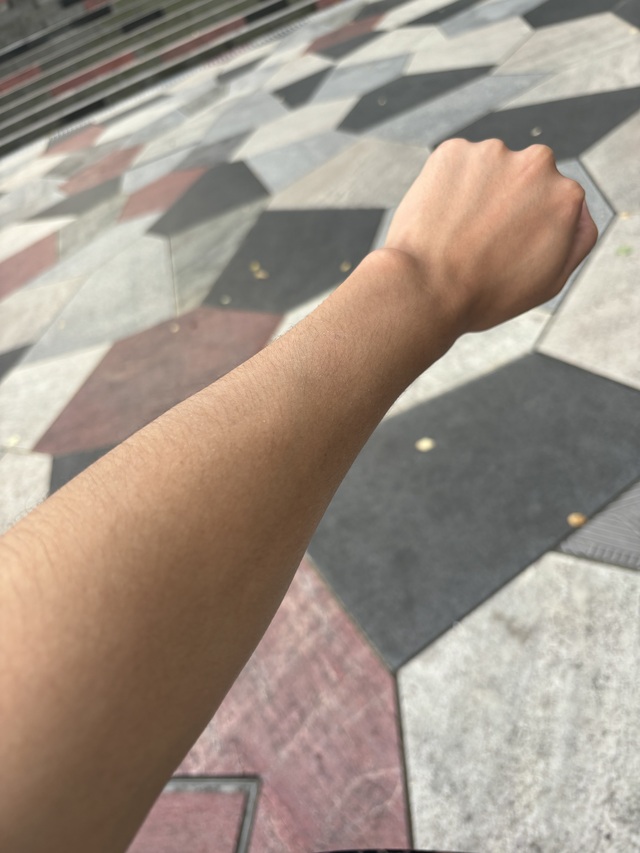 焼けちゃいました😅