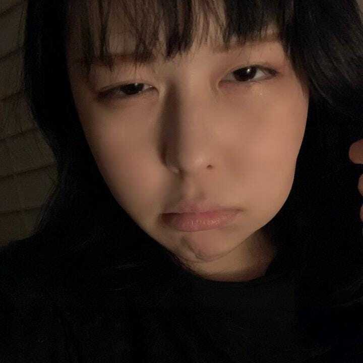 親知らず抜歯で輪郭が消しゴムになった